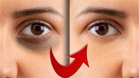 Tazelik Deposu: Göz Maskesi ile Göz Çevresi Bakımı